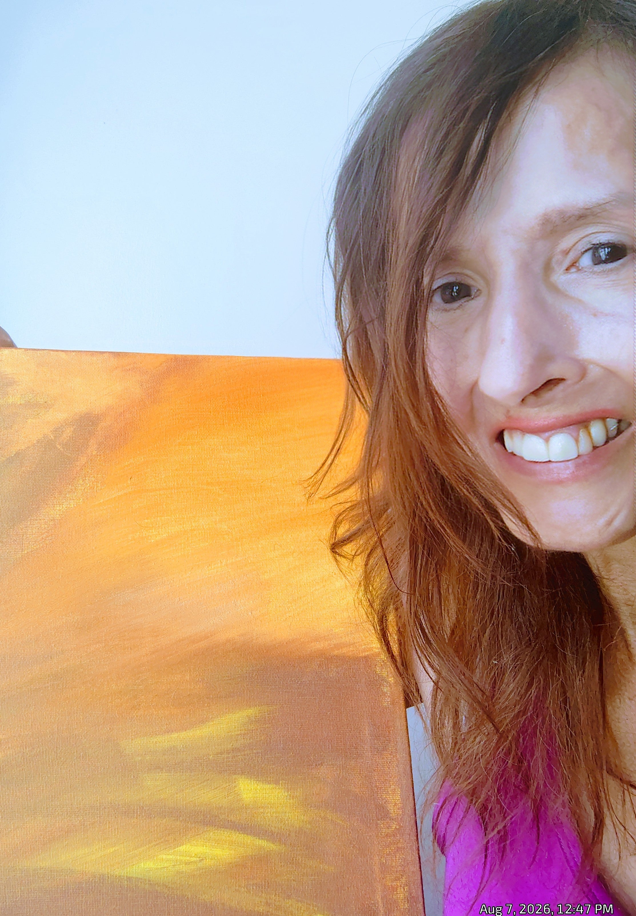 To Everyone Living with Scleroderma: You Are Not Alone